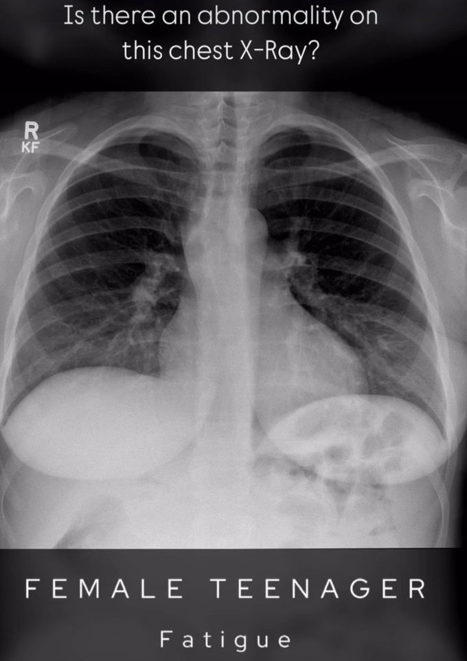 Identify the Abnormality