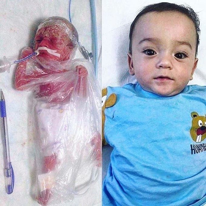 The boy who recovered amazingly