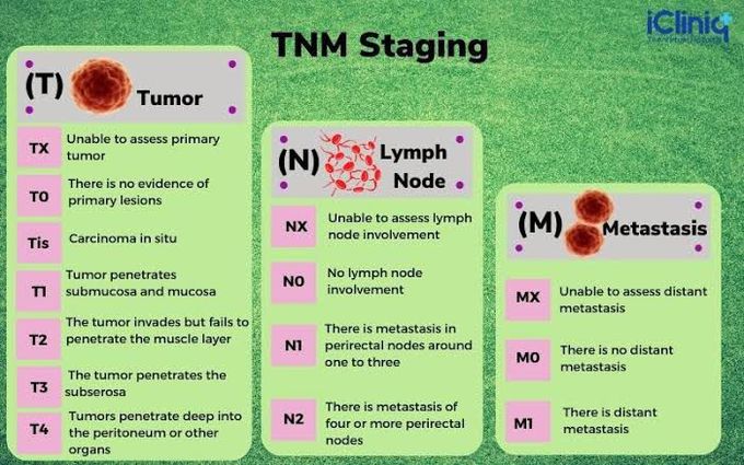 TNM staging of cancer