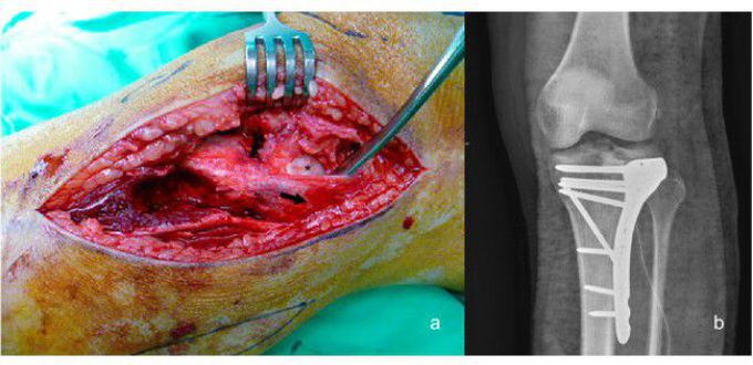 Trauma case report