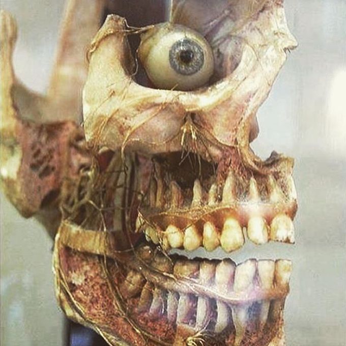 Skull