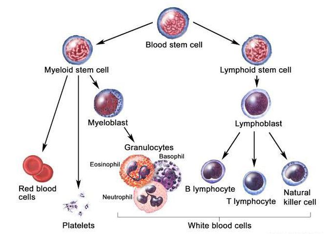 Acute lymphocytic leukemia