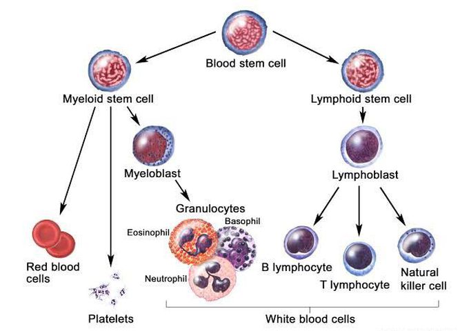 Acute lymphocytic leukemia