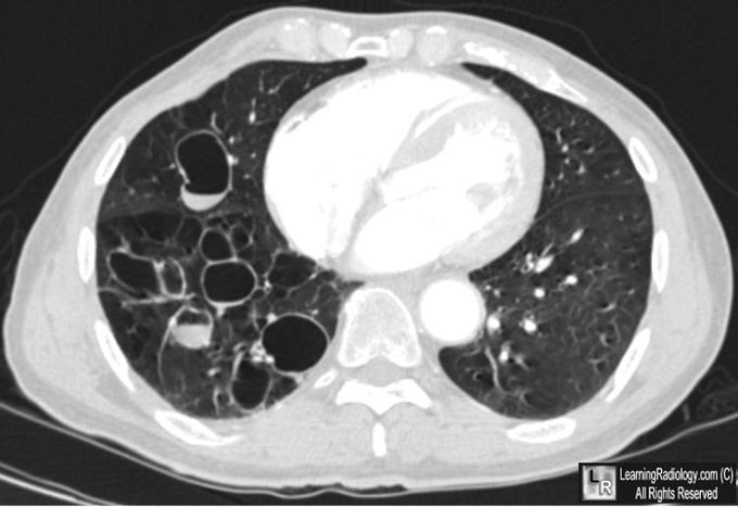 What's your diagnosis?