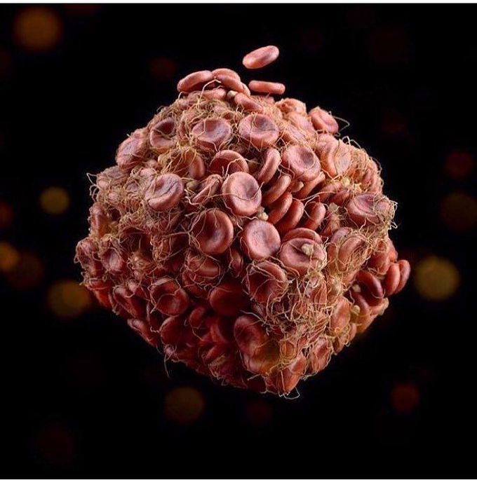 Incredible image of a blood clot!