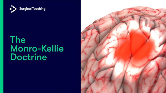 Monro-Kellie Doctrine