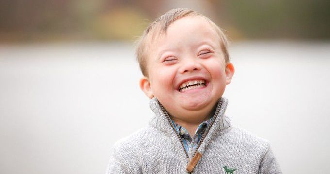 Down syndrome