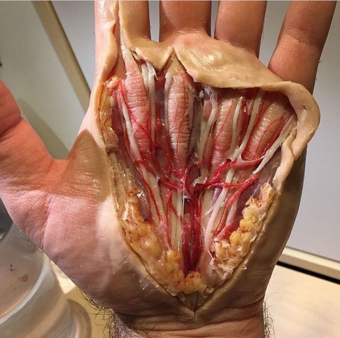 Which anatomical structures can you see in this picture?
