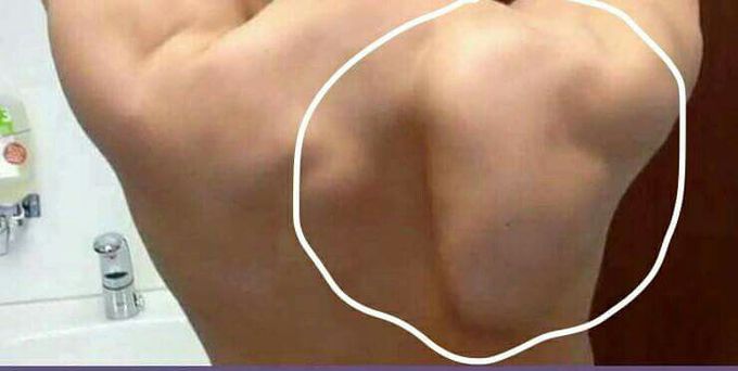 Wt is d diagnosis