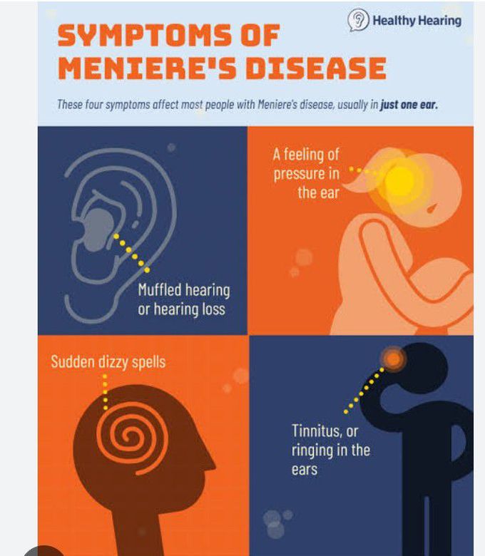 Symptoms of meniers disease