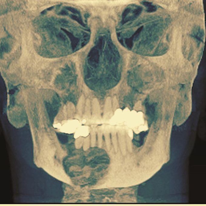 The human facial skeleton 👨‍⚕️🤗
