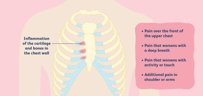 These are the symptoms of Tietz syndrome