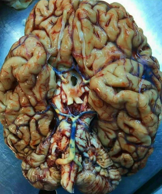 Brain