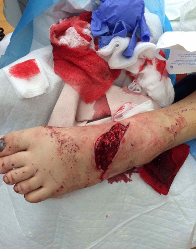 trauma surgery