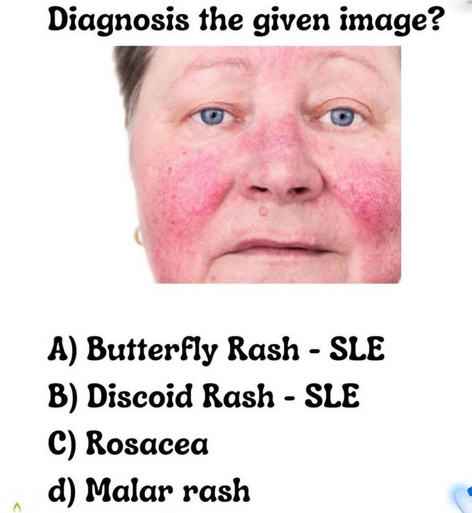 Diagnose It