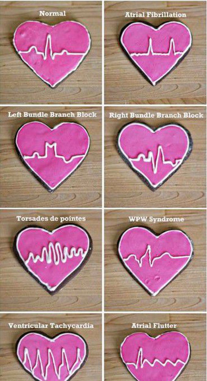 Heart rate anormalities