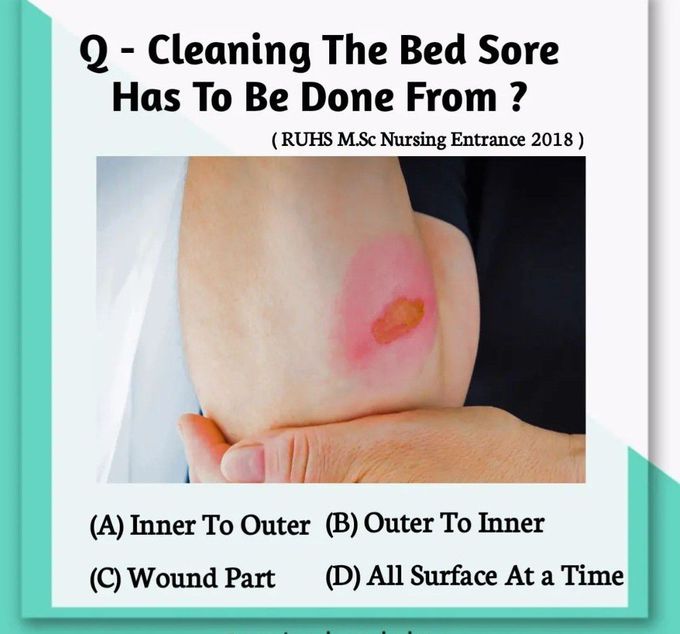 Bed Sore