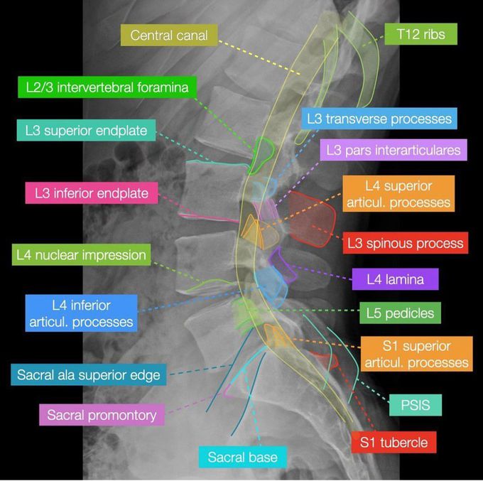 Spine Radiology II