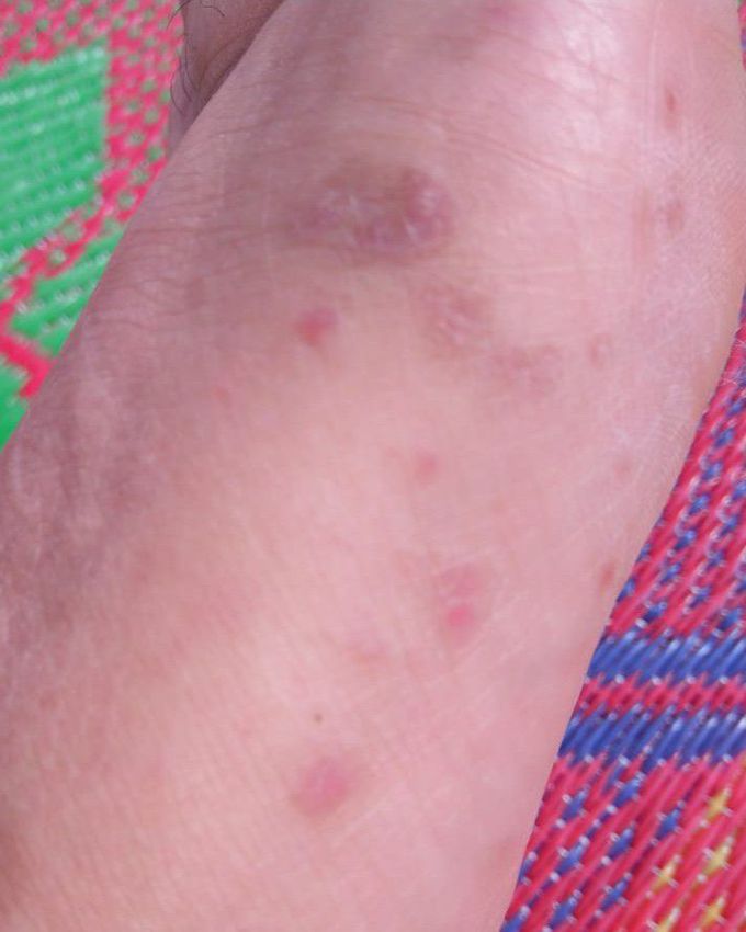 Differential Diagnosis Needed.