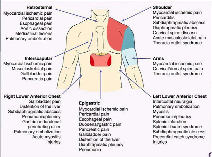 Different types of pain