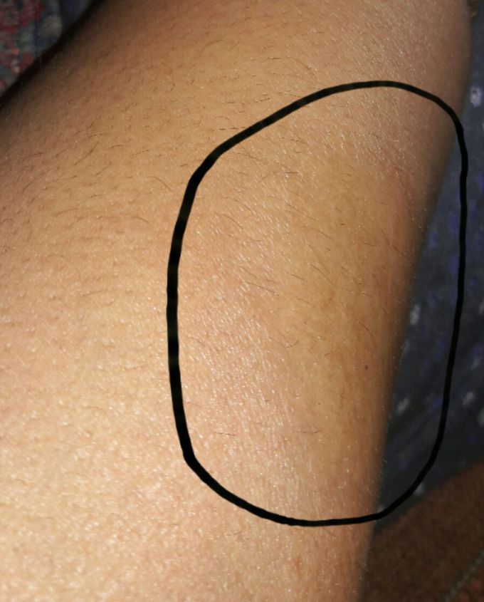 Skin color changed