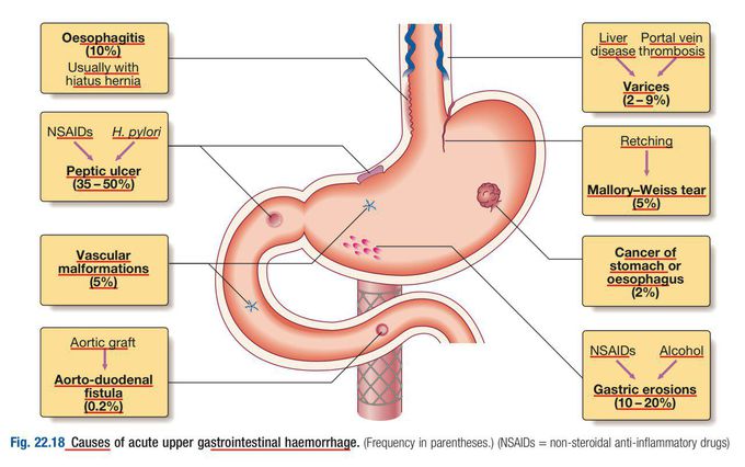 Acute Upper GIT Haemorrhage