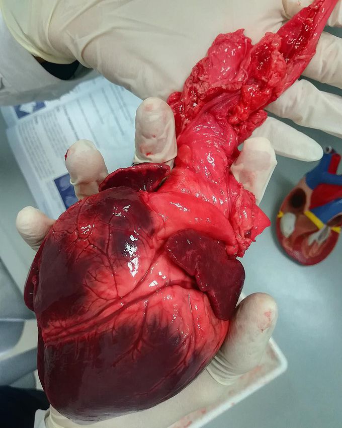 Hearts are forever glorious.  