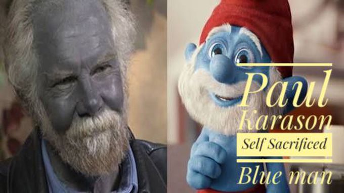 Papa Smurf Paul turns himself blue after taking dietary supplements for  several years, US, News