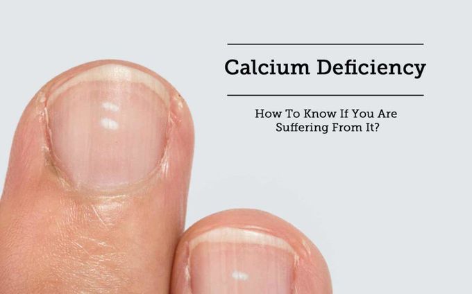 Calcium deficiency