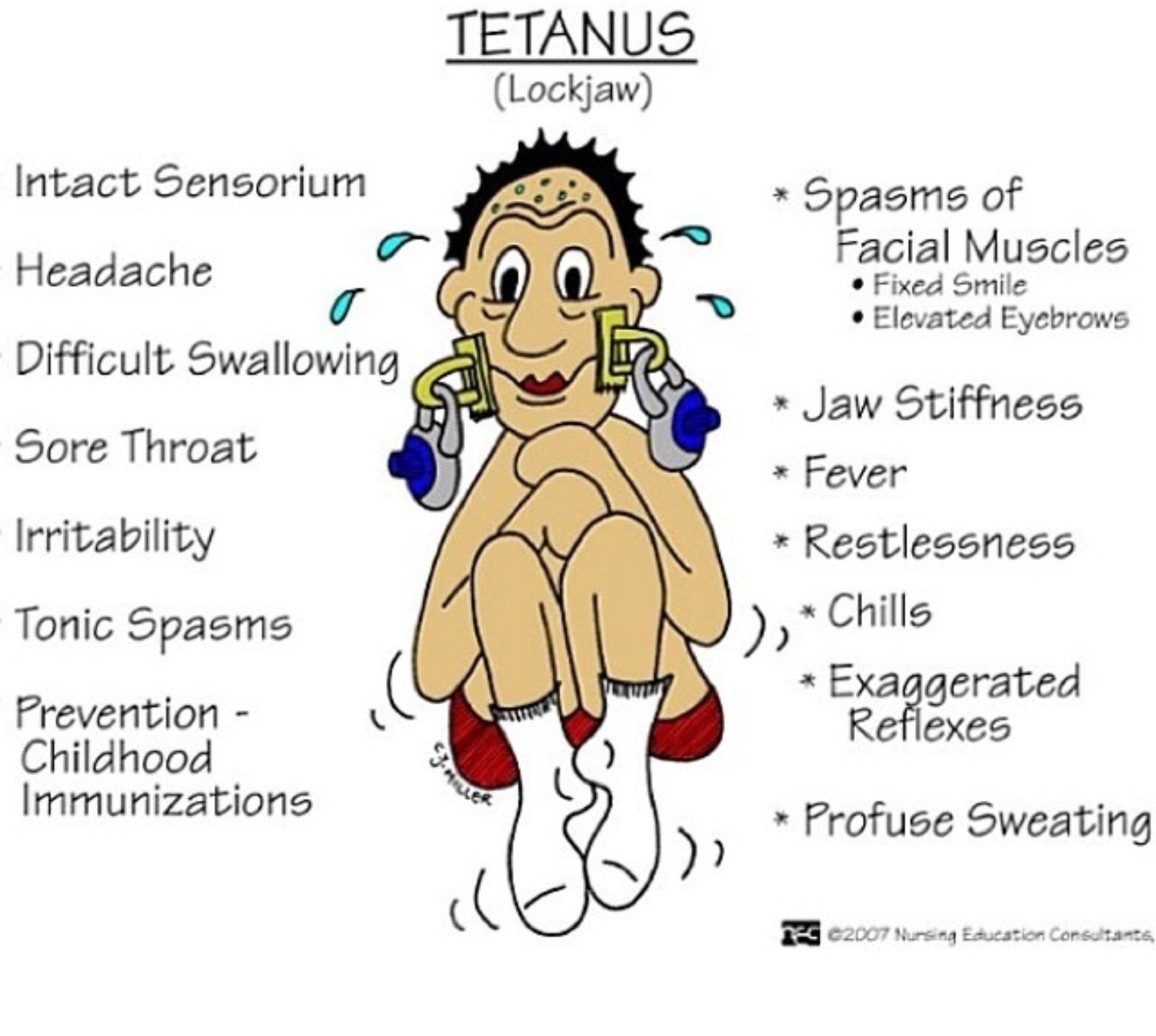 Tetanus Lockjaw Symptoms Tetanus | Definition, Causes, Symptoms,