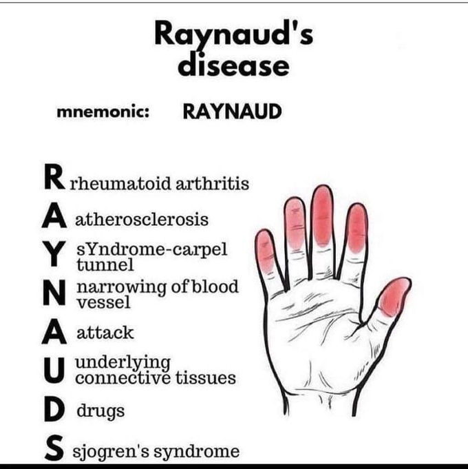 RAYNAUD'S DISEASE