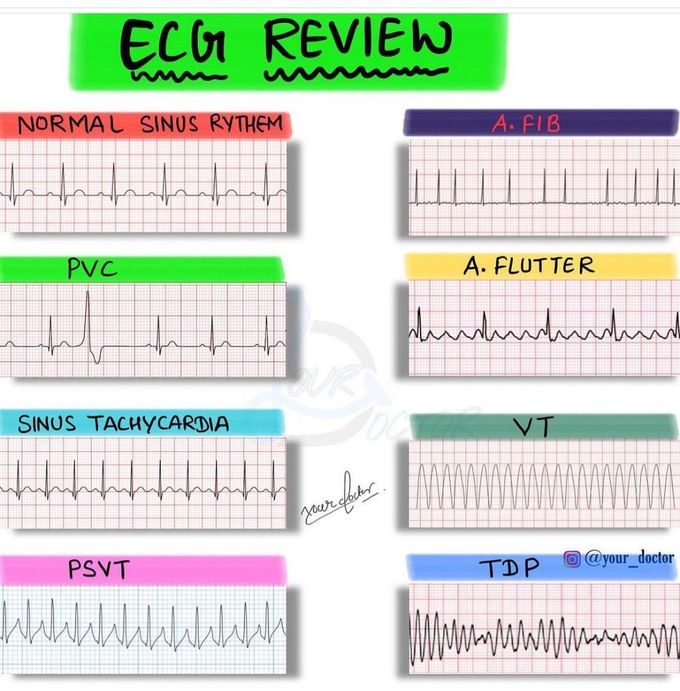 ECG Review - MEDizzy