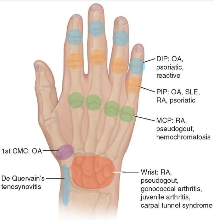 Hand Diseases