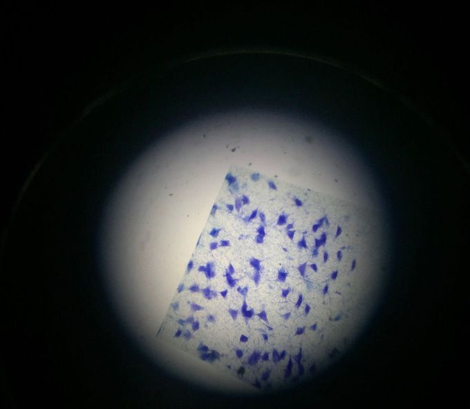 Nerve Cells/ Neurons