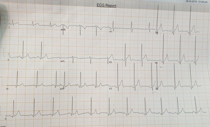 What's your diagnose