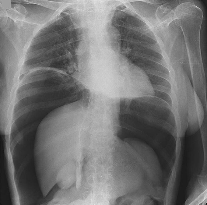 What’s your diagnosis ?!