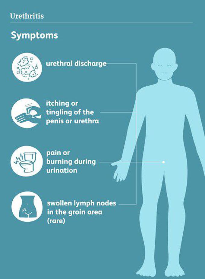 These are the symptoms of Urethritis syndrome