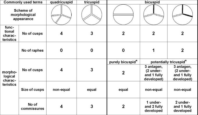 Sievers Classification of Bicuspid Aortic Valve