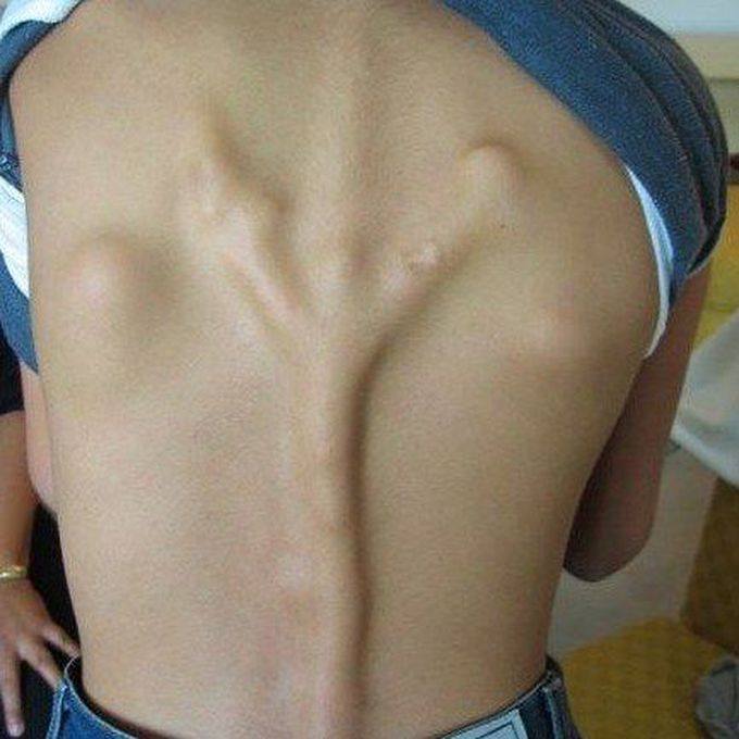 What is the case / condition??