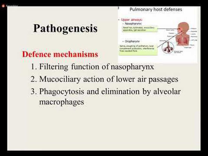 Presentation of Pulmonary Infection - Detailed