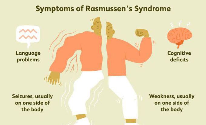 These are the symptoms of Rasmussen syndrome