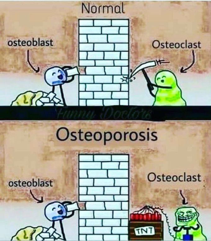 Osteoporosis❗