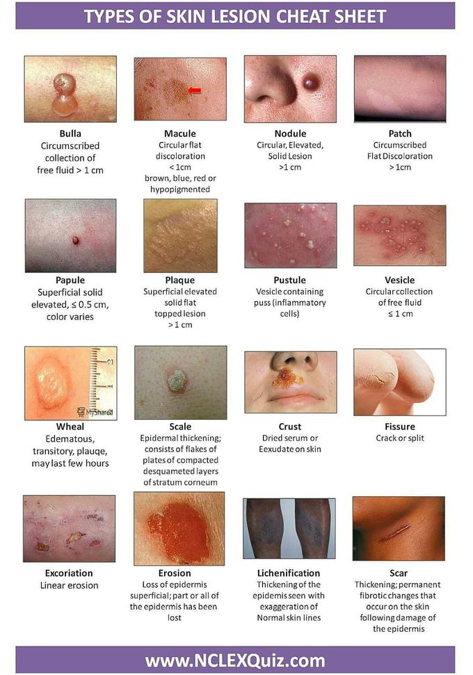 Skin pathology