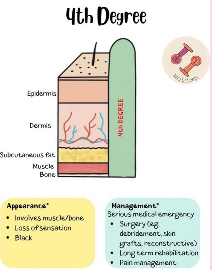 4th Degree Burn