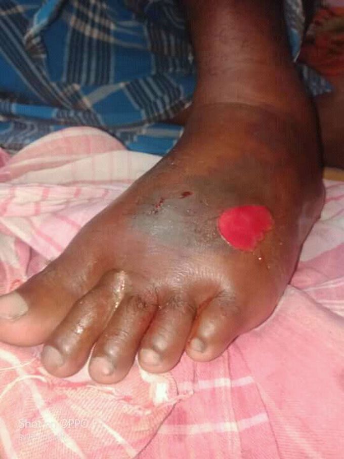 Your treatment plzzzzzzz