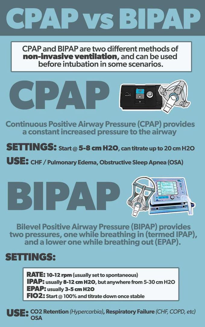 Non invasive Ventilation