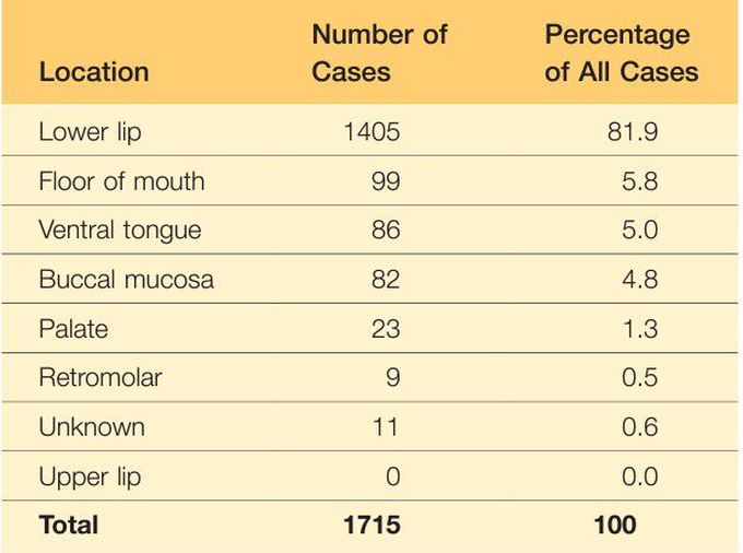 Location of mucocele