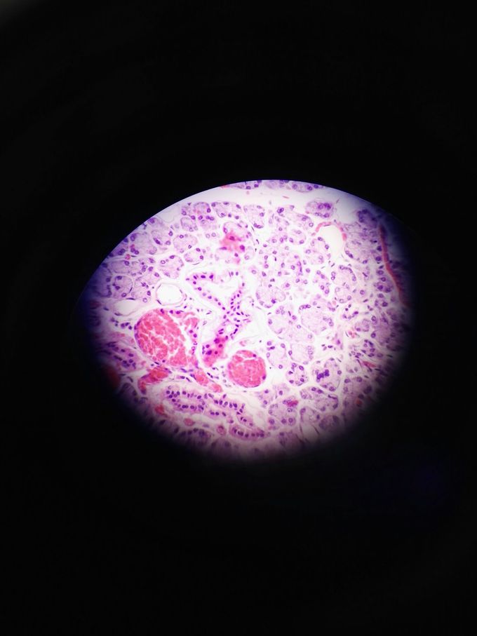 Parotid Gland