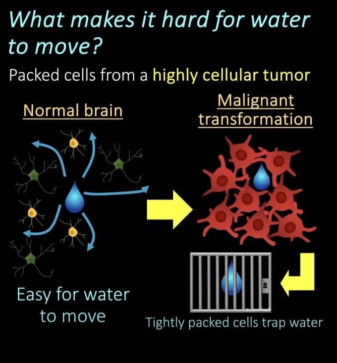 How to Read MRI IX