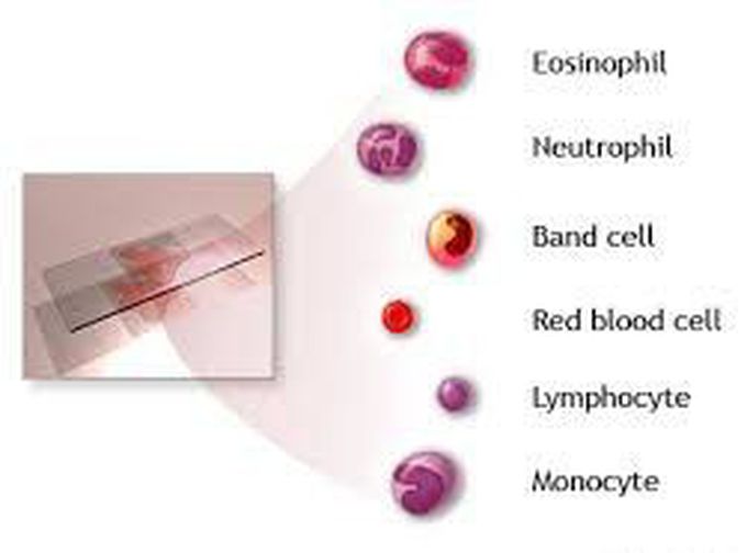 CBC complete blood count